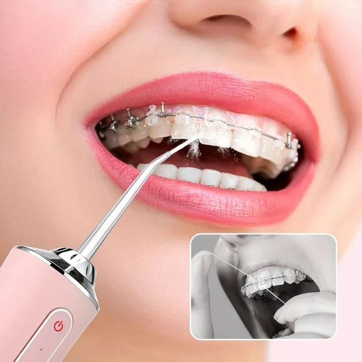 USB%20Portable%20Oral%20Irrigator%20Water%20Flosser%20Dental%20Water%20Jet%20Tools%20Pick%20Cleaning%20Teeth%20200ML%204%20Nozzles%20Mouth%20Oral%20Cleaning%20Agents%20-%20Image%204