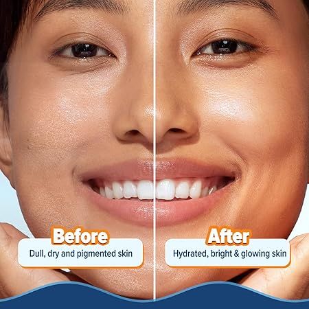 Aqualogica%20Glow+%20Hydra%20Gel%20Moisturizer%20%20200%20gm%20-%20Image%206