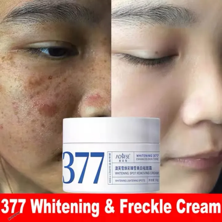 377%20Whitening%20Spot%20Removal%20Cream%2050%20GM%20-%20Image%203