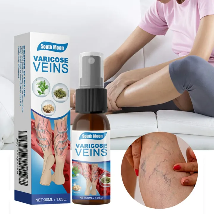South%20Moon%20Varicose%20Veins%20Treatment%20Spray%20%7C%20Advanced%20Solution%20for%20Spider%20Veins,%20Leg%20Pain%20&%20Swelling%20Relief%20-%20Image%202