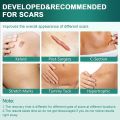 1Roll Professional Silicone Scar Sheets Scars Treatment - Reusable Silicone Scar Strips Type for Keloid, C-Section, Surgery,Burn. 