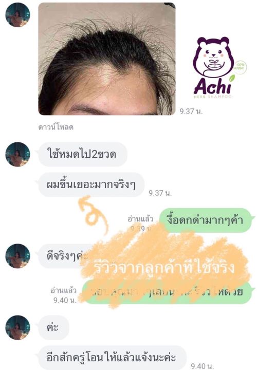 Achiherb%20Children's%20Shampoo%20Accelerates%20Hair%20Growth%20and%20Makes%20It%20Black.%20Achiherb%20Can%20Be%20Used%20by%20All%20Ages.%20Newborns%20-%20Adults%20Hair%20Loss%20after%20Giving%20Birth%20Is%20Good%20for%20Use.%20-%20Image%202