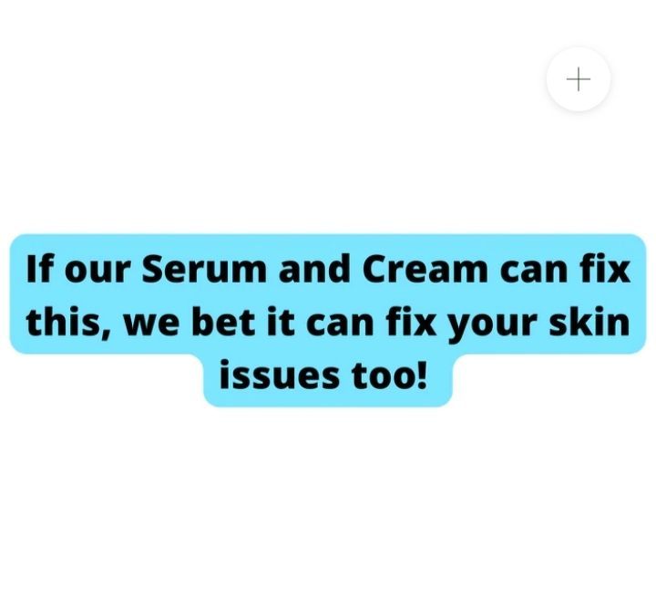 Nutra%20white%20Extreme%20Strong%20Whitening%20Kit%20Glutathione%20Cream%20&%20Serum%20-%20Image%202