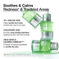 Anua Azelaic Acid 10 Hyaluron Redness Soothing Serum, Facial Serum for Sensitive skin, Hyaluronic Acid, Niacinamide, Spot Care. 