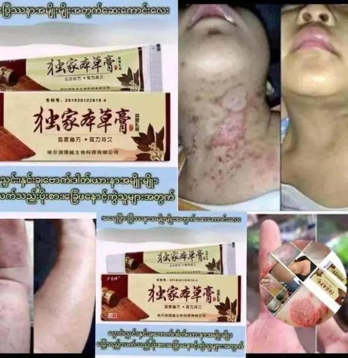 2-/%20%E1%80%95%E1%80%BD%E1%80%B1%E1%80%B8%E1%81%8A%20%E1%80%9D%E1%80%B2%E1%81%8A%E1%80%82%E1%80%BB%E1%80%BD%E1%80%90%E1%80%BA%20/%E1%80%92%E1%80%90%E1%80%BA%20%E1%80%94%E1%80%BE%E1%80%84%E1%80%BA%E1%80%B8%E1%80%81%E1%80%B0%E1%81%8A%20%E1%80%9A%E1%80%AC%E1%80%B8%E1%80%94%E1%80%AC%E1%80%95%E1%80%BC%E1%80%B1%E1%80%AC%E1%80%80%E1%80%BA%E1%80%86%E1%80%B1%E1%80%B8%0A%0A4-%E1%80%A1%E1%80%99%E1%80%AC%E1%80%9B%E1%80%BD%E1%80%90%E1%80%BA/%20%E1%80%95%E1%80%BD%E1%80%B1%E1%80%B8%E1%81%8A%20%E1%80%9D%E1%80%B2%E1%81%8A%E1%80%82%E1%80%BB%E1%80%BD%E1%80%90%E1%80%BA%20/%E1%80%92%E1%80%90%E1%80%BA%20%E1%80%94%E1%80%BE%E1%80%84%E1%80%BA%E1%80%B8%E1%80%81%E1%80%B0%E1%81%8A%20%E1%80%9A%E1%80%AC%E1%80%B8%E1%80%94%E1%80%AC%0A%E1%80%A1%E1%80%99%E1%80%BB%E1%80%AD%E1%80%AF%E1%80%B8%E1%80%99%E1%80%BB%E1%80%AD%E1%80%AF%E1%80%B8%20%E1%80%94%E1%80%BE%E1%80%84%E1%80%BA%E1%80%B7%20%E1%80%A1%E1%80%9B%E1%80%B1%E1%80%A1%E1%80%95%E1%80%BC%E1%80%AC%E1%80%B8%E1%80%A1%E1%80%90%E1%80%BD%E1%80%80%E1%80%BA%E1%80%A1%E1%80%91%E1%80%B0%E1%80%B8%E1%80%9E%E1%80%90%E1%80%84%E1%80%BA%E1%80%B8%E1%80%9C%E1%80%BD%E1%80%BE%E1%80%AC%E1%80%95%E1%80%AB%E1%80%B8%E1%80%A1%E1%80%95%E1%80%BA%E1%80%95%E1%80%AB%E1%80%9E%E1%80%8A%E1%80%BA%0A%0A%E1%80%A1%E1%80%9B%E1%80%B1%E1%80%A1%E1%80%95%E1%80%BC%E1%80%AC%E1%80%B8%E1%80%9B%E1%80%B1%E1%80%AC%E1%80%82%E1%80%AB%E1%80%A1%E1%80%99%E1%80%BB%E1%80%AD%E1%80%AF%E1%80%B8%E1%80%99%E1%80%BB%E1%80%AD%E1%80%AF%E1%80%B8%E1%80%A1%E1%80%90%E1%80%BD%E1%80%80%E1%80%BA%20%E1%80%90%E1%80%9B%E1%80%AF%E1%80%90%E1%80%BA%E1%80%9B%E1%80%AD%E1%80%AF%E1%80%B8%E1%80%9B%E1%80%AC%20%E1%80%90%E1%80%AD%E1%80%AF%E1%80%84%E1%80%BA%E1%80%B8%E1%80%9B%E1%80%84%E1%80%BA%E1%80%B8%E1%80%86%E1%80%B1%E1%80%B8%E1%80%A1%E1%80%86%E1%80%AE%20%E1%80%90%E1%80%85%E1%80%BA%E1%80%99%E1%80%BB%E1%80%AD%E1%80%AF%E1%80%B8%E1%80%80%E1%80%AD%E1%80%AF%20%E1%80%90%E1%80%9B%E1%80%AF%E1%80%90%E1%80%BA%E1%80%94%E1%80%AD%E1%80%AF%E1%80%84%E1%80%BA%E1%80%84%E1%80%B6%E1%80%99%E1%80%BE%E1%80%90%E1%80%AD%E1%80%AF%E1%80%80%E1%80%BA%E1%80%9B%E1%80%AD%E1%80%AF%E1%80%80%E1%80%BA%E1%80%90%E1%80%84%E1%80%BA%E1%80%9E%E1%80%BD%E1%80%84%E1%80%BA%E1%80%B8%20-%20Image%202