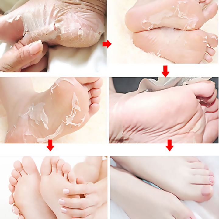 Exfoliating%20Feet%20Mask%20Sock%20Exfoliation%20Scrub%20for%20Feet%20Mask%20Remove%20Dead%20Skin%20Moisturizing%20Pedicure%20Anti%20Crack%20Foot%20Patch%20Spa%205PCS%20-%20Image%205