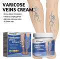 ointment for varicose veins Effective varicose vein relief cream to relieve Leg vasculitis phlebitis spider pain swelling Care. 