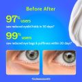 Chemist at Play New Under Eye Cream Dark Circles And Puffiness Reduction 15gm. 