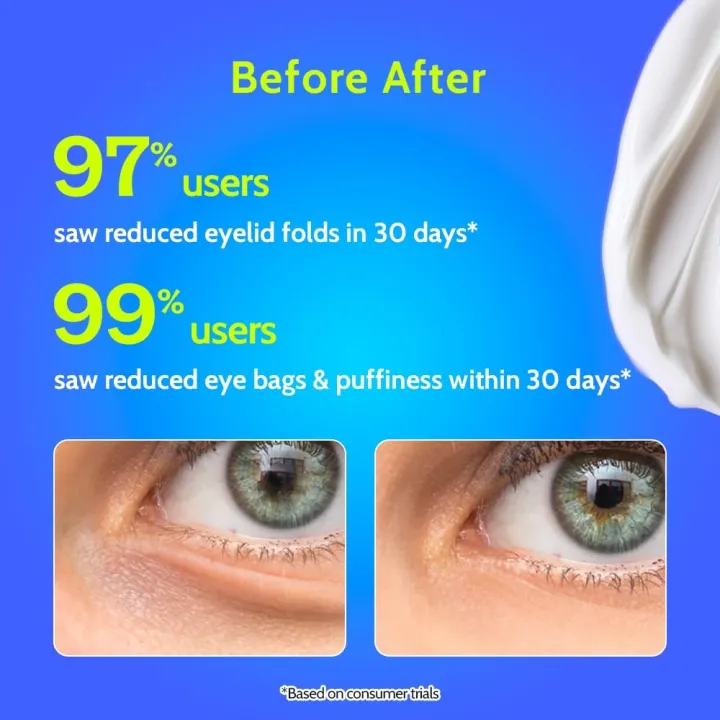Chemist%20at%20Play%20New%20Under%20Eye%20Cream%20Dark%20Circles%20And%20Puffiness%20Reduction%2015gm%20-%20Image%204