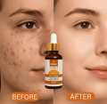 Relax Vitamin C Daily Serum 30ml - Brightening Tightening And Even Tone Formula. 