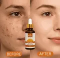 Relax Vitamin C Daily Serum 30ml - Brightening Tightening And Even Tone Formula. 