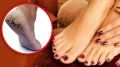 Pa Phata 20 ml,Removes cracked feet. 