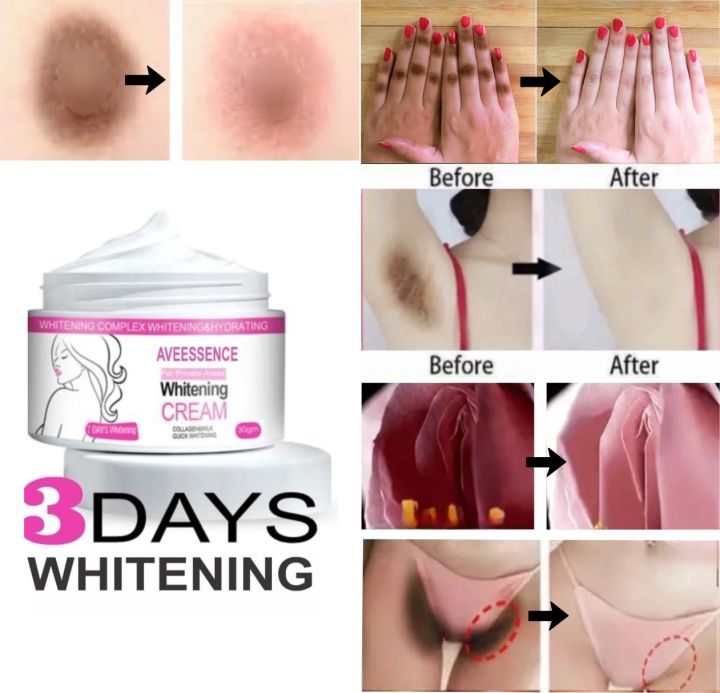 Aveessence%20private%20parts%20whitening%20cream%20for%20dark%20intimate%20areas%20-%20Image%205