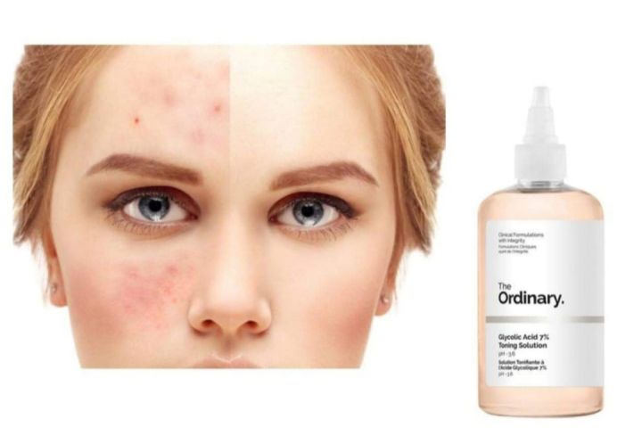 The%20Ordinary%20Glycolic%20Acid%207%25%20Exfoliating%20Toner%20240ml%20-%20CANADA%20-%20Image%205