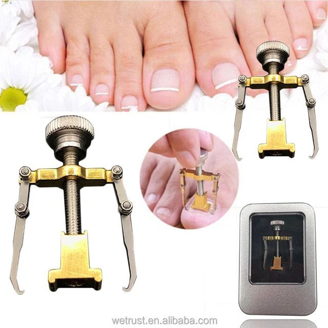 Professional Ingrown Toe Nail Recover Correction Fixer Manicure Pedicure Nails Care Tool