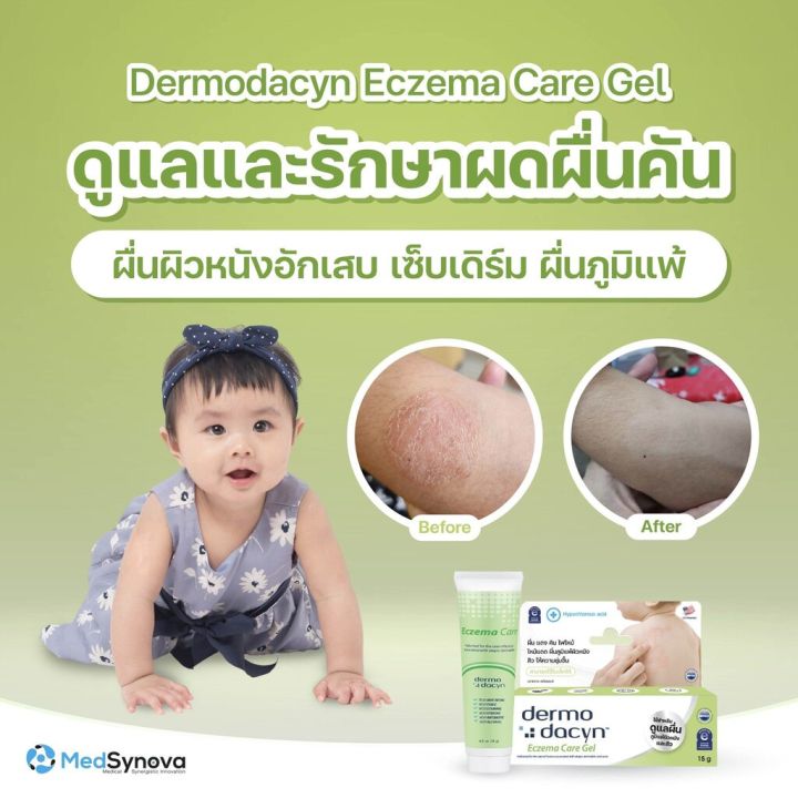 %5BProduct%20Available%20in%206%20Types%5D%20Dermodacyn%20Wound%20Hydrogel/Wound%20Care%20Spray/Oral%20Care%20Spray/Eczema%20Care%20Gel/Post%20Procedure%20Hydrogel/Medsynova%20Zelique%20Skin%20Body%20Cream%20-%20Dermodacyn%20-%20Image%205