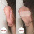 10 Pcs Ear Corrector Sticker Stronger Ear Tape Patches Double sided Adhesive to Hold Back Protruding Ears. 