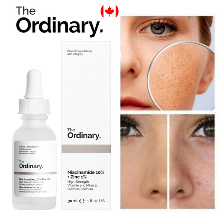 The Ordinary Niacinamide 10% Zinc 1% 30Ml