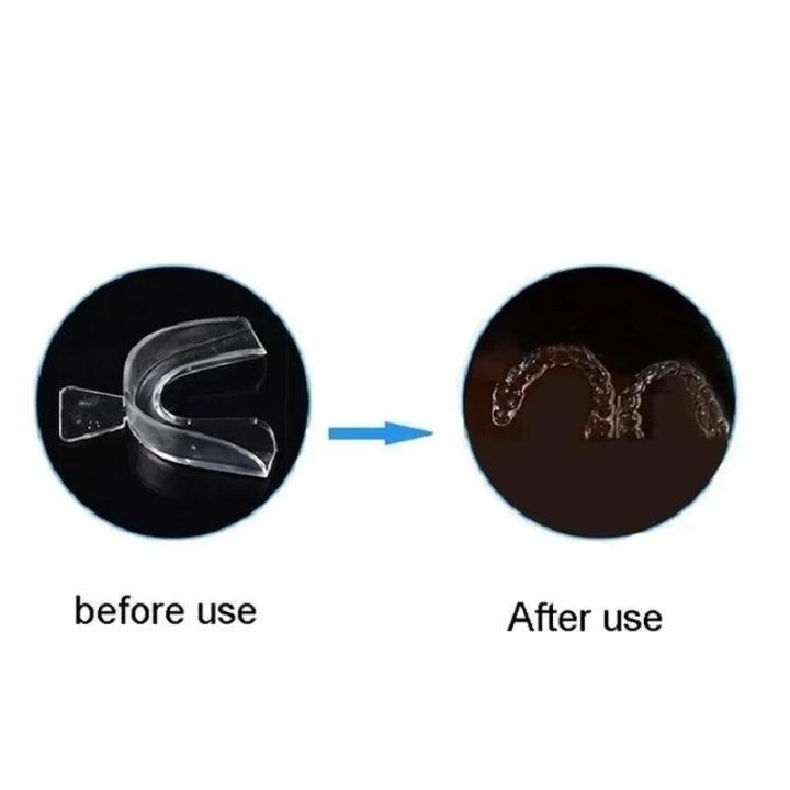 Professional%20Teeth%20%20Tray%20Tooth%20Protector%20Gum%20Dental%20Products%20Teeth%20Straightener%20Teeth%20%20Kit%20Dental%20Dente%20Tools%20-%20Image%204