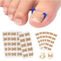 professional Nail Correction Stickers Ingrown Toenail Corrector Patches Paronychia Treatment Recover Corrector Pedicure Tools. 