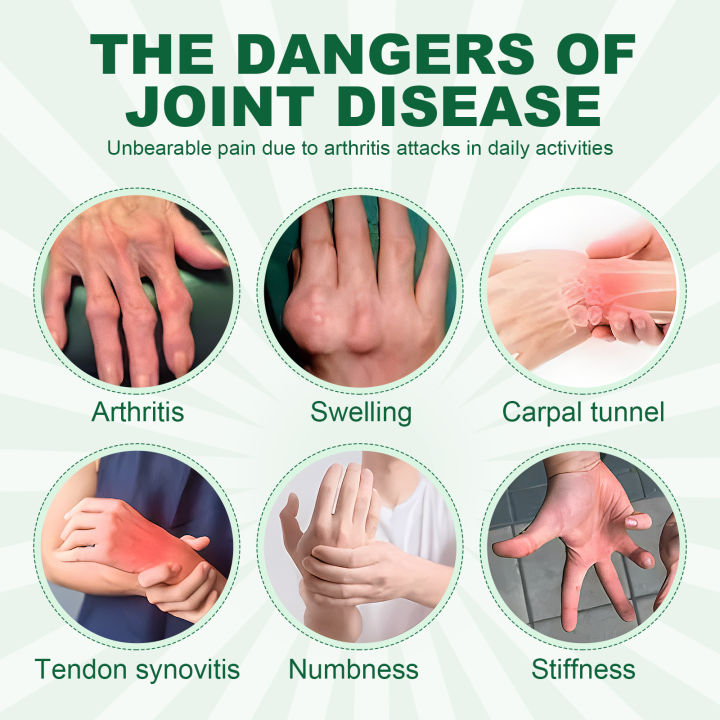 Magnetic%20Arthritis%20Therapy%20Gloves%20Rheumatoid%20Hand%20Wrist%20Pain%20Relief%20Finger%20Swelling%20Tenosynovitis%20Stimulate%20Blood%20Circulation%20-%20Image%206