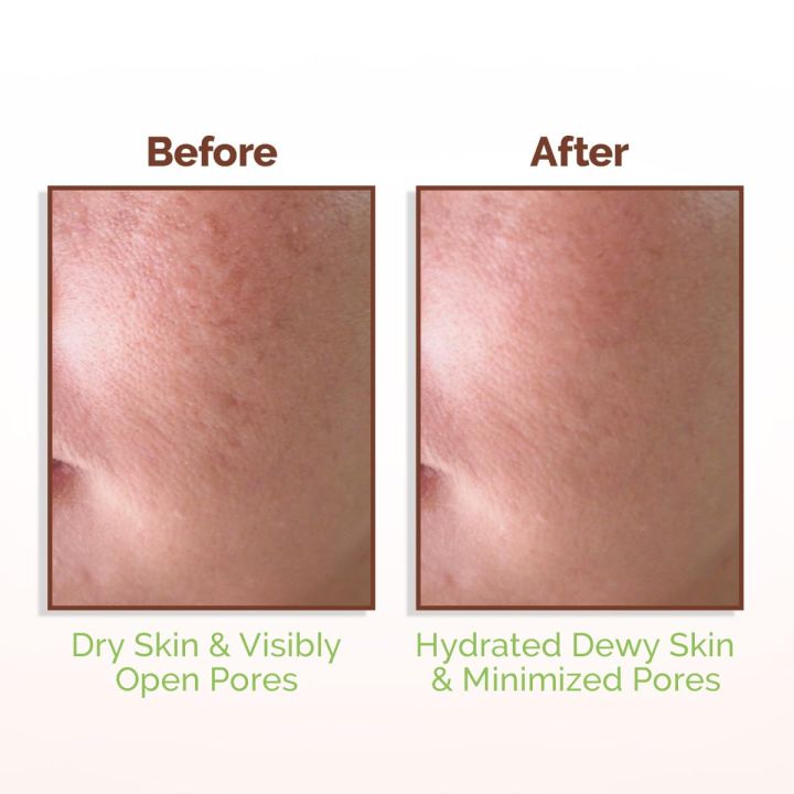 Mamaearth%20Rice%20Water%20Dewy%20Face%20Toner%20with%20Rice%20Water%20&%204%25%20Niacinamide%20for%20Glass%20Skin%20150ml%20-%20Image%204