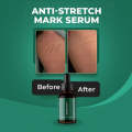 Markaway Stretch Mark Serum. 