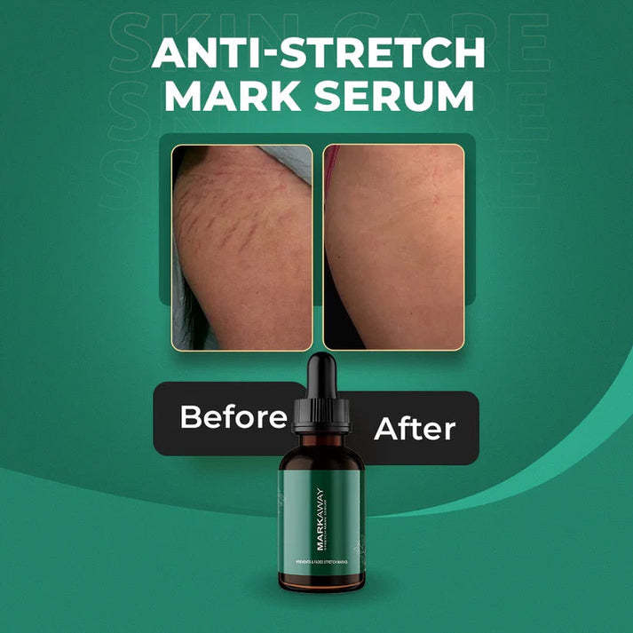 Markaway%20Stretch%20Mark%20Serum%20-%20Image%204