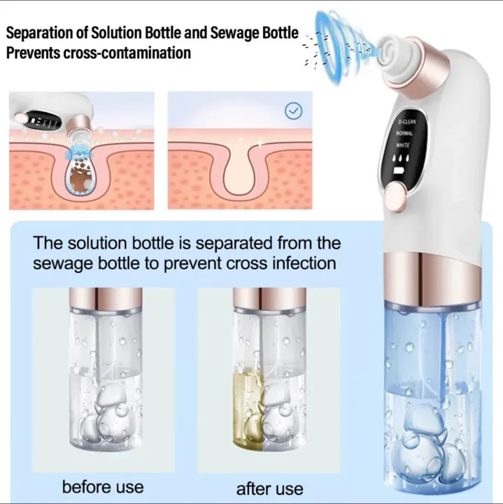 Electric%20Facial%20Pore%20Cleanser%20Cleaner%20Face%20Blackhead%20Zit%20Pimple%20Acne%20Suction%20Remover%20Skin%20Cleansing%20Tool%20-%20Image%203