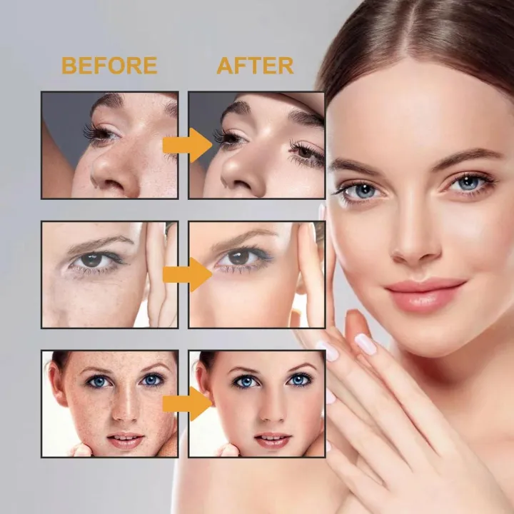 Daily%20Wish%20Beauty%20Cream%20Removes%20Acne,%20Pimples,%20Spots%20&%20Dark%20Circles%20Original%20Product%20-%20Image%205
