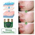 Breylee Salicylic skin care product Acid Acne Face Wash - 100g ( imported 100 % Authentic product ). 