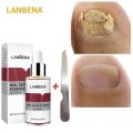 International Product Lanvena Nail Repair Essence Serum for Fungal Nail Treatment- 12ml. 