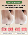 Permanent Laser Hair Removal Device, IPL Epilator, 900000 Flashes. 