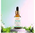 SKINO ACNE + SPOT TREATMENT SERUM 30ML (made in Bangladesh). 