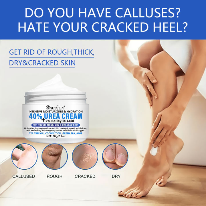 SUYARUN%2040%25%20Urea%20Foot%20Cream%20Stick%20-%20Moisturizing%20&%20Exfoliating,%20Cracked%20Heel%20Repair,%20Deep%20Hydration%20for%20Dry%20Feet,%20Long%20Protect.%20-%20Image%205