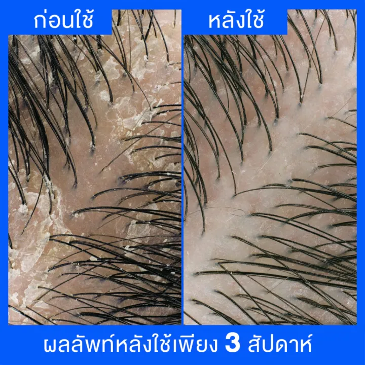 Old%20Spice%20X%20head%20&%20shoulders%20Ultramen%20shampoo%20anti-dandruff%20pure%20sport%20shampoo%20-%20Image%204