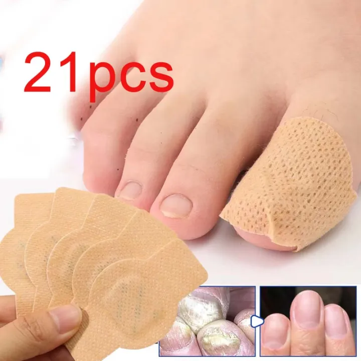 Nail%20Fungus%20Patch%20Waterproof%20Nail%20Repair%20Patch%20Ingrown%20Correction%20Sticker%20Damaged%20Nail%20Gray%20Care%20Patch%20Feet%20Care%20Tools%20-%20Image%202