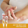 Professional Skin Care Cream Expert Skin Fighter for Psoriasis and Dermatitis for Healthy Skin 15g. 