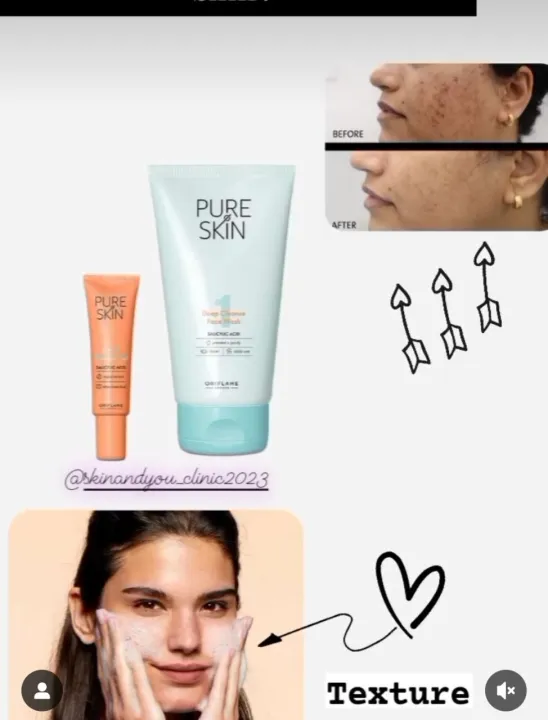 oriflame%20Pure%20skin%20facewash,%20Sos%20gel%20acne%20treatment,%20for%20oily%20skin%20,remove%20acne,acne%20spots,scars%20women%20accessories%20-%20Image%207