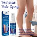 OUHOE Varicose Vein Spray (30ml).