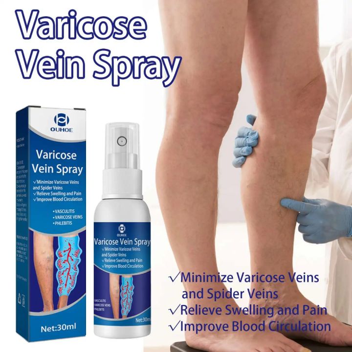 OUHOE%20Varicose%20Vein%20Spray%20(30ml)%20-%20Image%203
