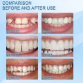 Resin Tooth Repair Glue Shapeable Teeth Gaps Filling Solid Glue Temporary Teeth Repair Falseteeth Glue Safety Dental Supplies. 
