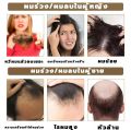 Meidu Premium Anti-Hair Loss & Hair Growth Shampoo 500ml - Nourishing Treatment for Thinning Hair. 
