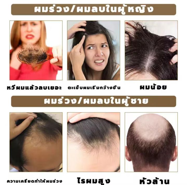 Meidu%20Premium%20Anti-Hair%20Loss%20&%20Hair%20Growth%20Shampoo%20500ml%20-%20Nourishing%20Treatment%20for%20Thinning%20Hair%20-%20Image%207