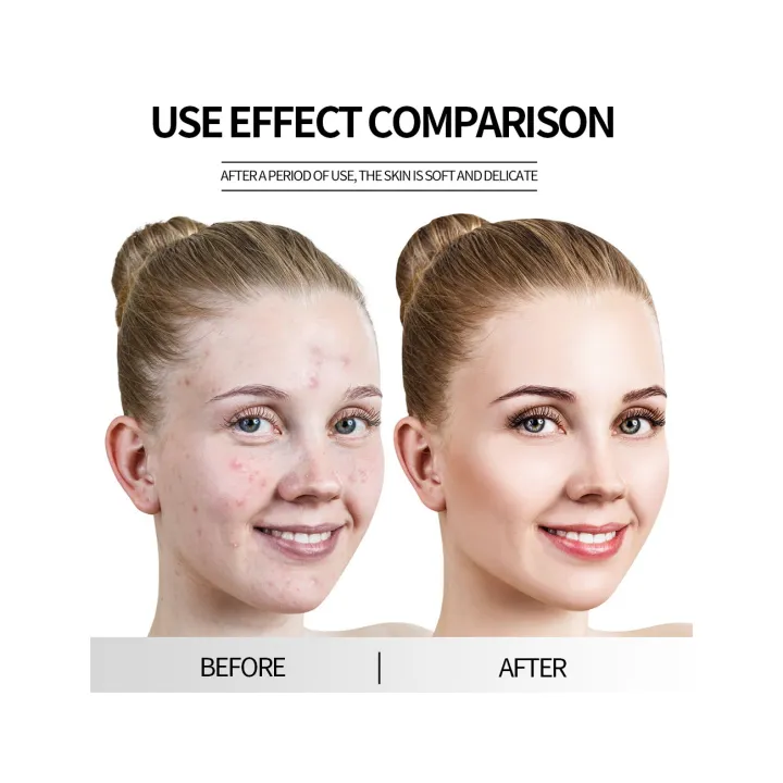 Daily%20Wish%20Beauty%20Cream%20Removes%20Acne,%20Pimples,%20Spots%20&%20Dark%20Circles%20Original%20Product%20-%20Image%206