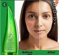 MAT beauty aelo vera gel. 
