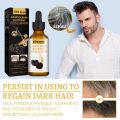 South Moon Ganoderma Nutrient - Natural Darkening Hair Serum (30ml / 1.05 fl oz). 
