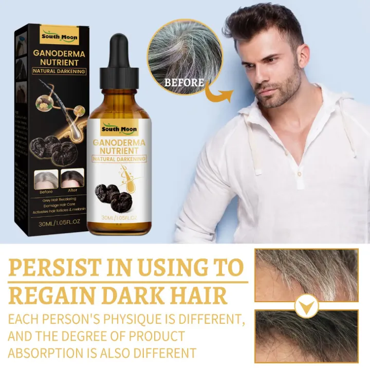 South%20Moon%20Ganoderma%20Nutrient%20-%20Natural%20Darkening%20Hair%20Serum%20(30ml%20/%201.05%20fl%20oz)%20-%20Image%203