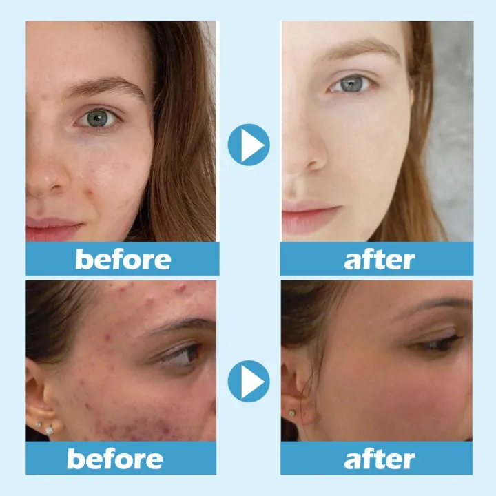 Jskin%20Beauty%20Hydra%20Moist%20Ice%20Water%20Sleeping%20Mask%20100g%20&%20Free%20Pack%20Brush%20-%20Image%206