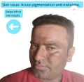 Nutra White Glutathione 30X Extreme Strong Whitening cream. 